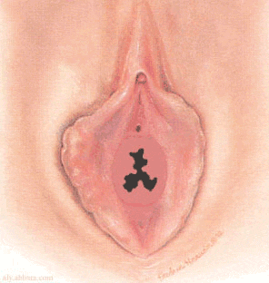 imene frangiato