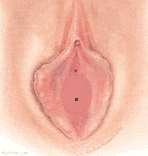imene microperforato
