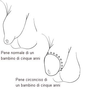width=