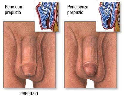  width=