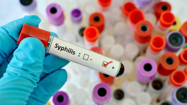 sifilide come riconoscere il contaagio