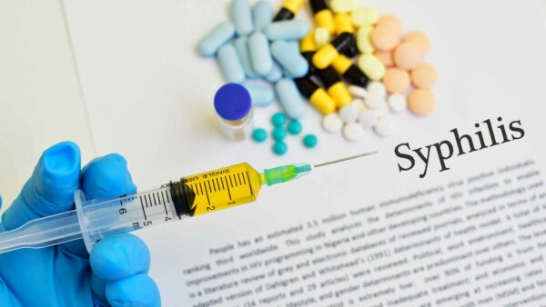 sifilide in che modo si contrae