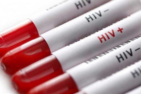 sieropositività da hiv e aids