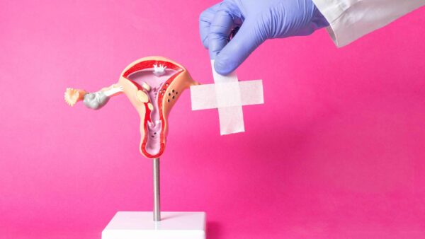 terapia per endometriosi