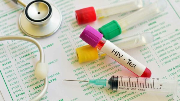 mst e hiv Uganda