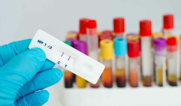 hiv test