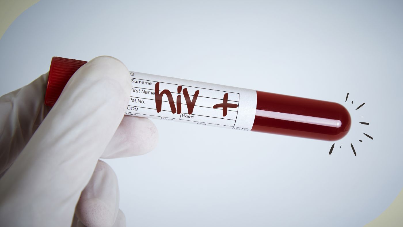 HCV e HIV test