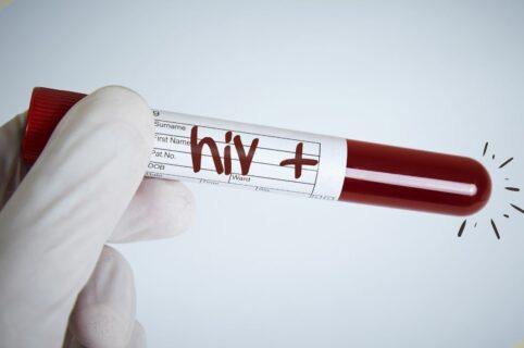 HCV e HIV test