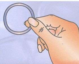 anello contraccettivo